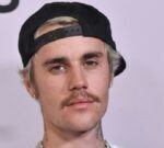Justin Bieber sufre parálisis en mitad del rostro