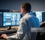 Un código de barras permite rastrear tumor cerebral