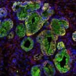 fotopancreas1-150x150-1
