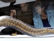 Fractura de vértebras por osteoporosis: Mujer, 76 años y no siempre tratada