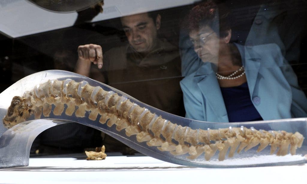 vértebras osteoporosis