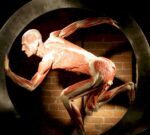 Trocanteritis, ese intenso y complejo dolor en la cadera