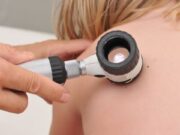 Concientización y Prevención del Cáncer de Piel en Barrios Vulnerables