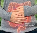 Un ensayo clínico revela un método natural y efectivo para recudir la recurrencia en el cáncer colorrectal