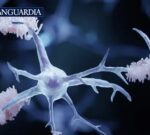 El Alzheimer ya se puede diagnosticar precozmente con un análisis de sangre