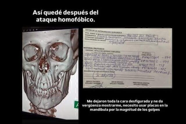 Brutal-golpiza-a-un-joven-gay-en-Palermo