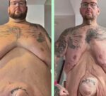 Perdió 154 Kg tras dejar de consumir sustancias ilícitas