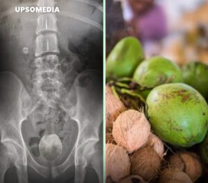 fotoano-frutas1-300x264-1