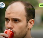 Científicos revelan consumo frecuente de bebidas azucaradas que tiene relación con la calvicie
