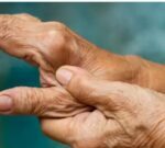 La artrosis de mano puede diagnosticarse de forma precoz para tratarse con éxito