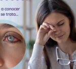 ¿Sentís los Ojos Secos?