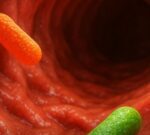 La esclerosis comienza en el estómago