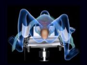 Dar a luz es uno de los dolores más intensos