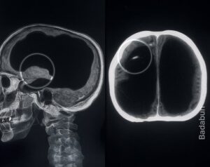 fotocerebro2-300x238-1