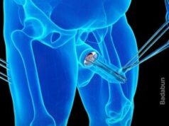 Tres datos de la circuncisión que toda mujer debe saber