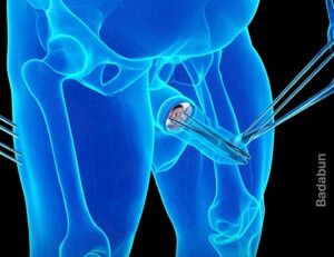 fotohombrepene1-300x231-1