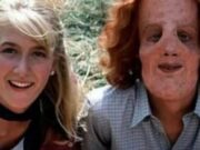 El chico que demostró que la belleza no es solo externa