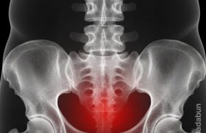 Cada vez más son los hombres diagnosticados con cáncer de próstata