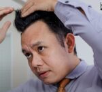 El Presidente de Corea del Sur quiere ayudar a cubrir los tratamientos por pérdida de cabello