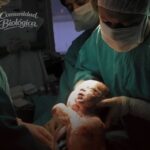 Los partos por cesárea están impulsando una condición mortal