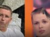 Un empresario en Rusia golpeó brutalmente a su novia hasta causarle la pérdida de parte de su cráneo
