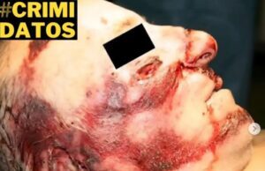 La fuerza de la naturaleza: ¿Cómo actúan los rayos en el cuerpo humano?