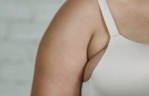 Las mujeres con senos grandes tendrìan màs posibilidades de sufrir migrañas crònicas